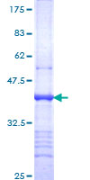12.5% SDS-PAGE Stained with Coomassie Blue